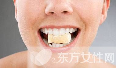 牙齿美白方法有哪些 十大方法让你拥有一口洁白牙齿