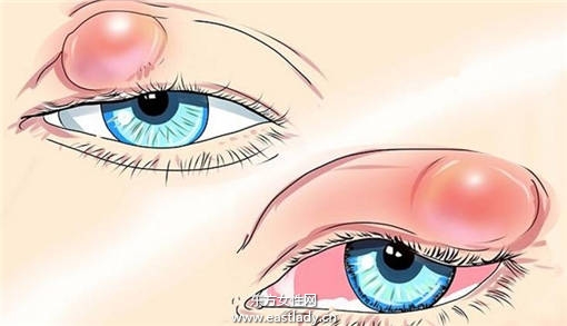 偷看别人洗澡会长针眼 科学让你知道为什么会长针眼
