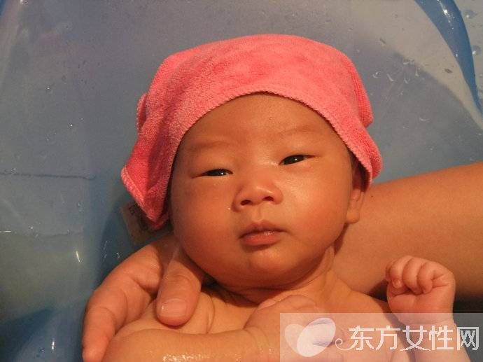 母乳性黄疸怎么治疗 如何预防婴儿母乳性黄疸