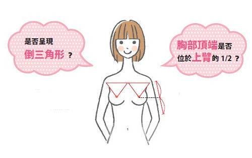 胸外扩可以纠正过来嘛 产后美胸还你自信美丽人生