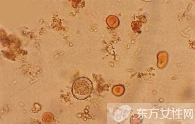 弓形虫病的症状是什么 7大健康饮食教你预防