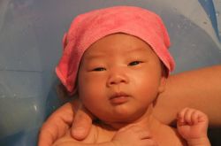 母乳性黄疸怎么治疗 如何预防婴儿母乳性黄疸