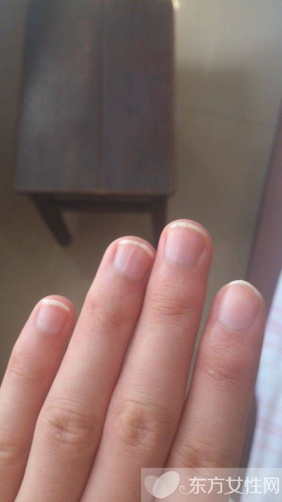 你健康吗 指甲半月痕反映你的健康状况
