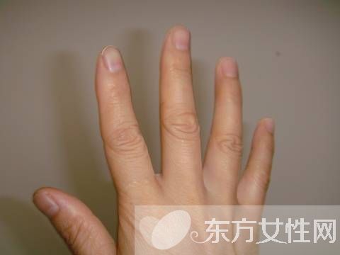 你健康吗 指甲半月痕反映你的健康状况