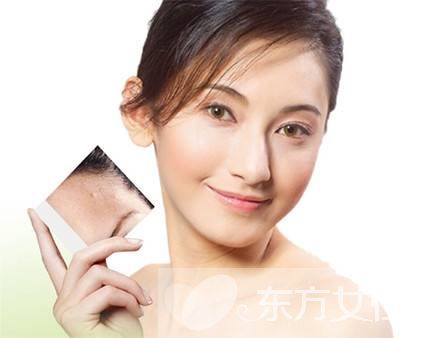 什么方法最快去痘印 温馨小提示不可忘哦