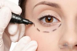 眼袋是怎么形成的 这些小妙招可以有效去除眼袋哦