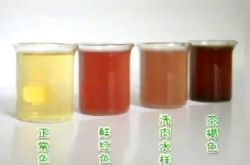 女人小便很黄怎么回事 怎么从尿的颜色看健康