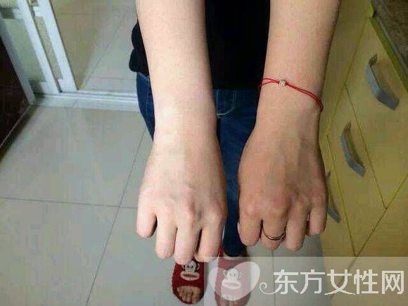 晒黑怎么快速变白 10个美白小偏方告诉你