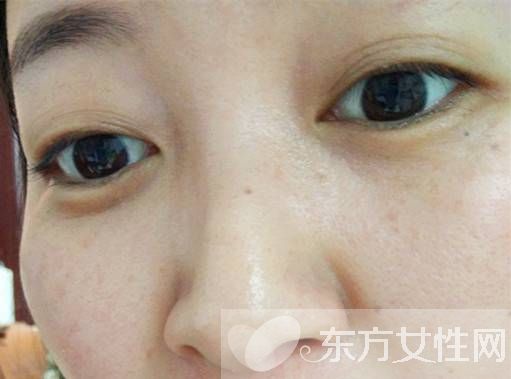 脸部色斑形成的原因 教你在家自制祛斑面膜