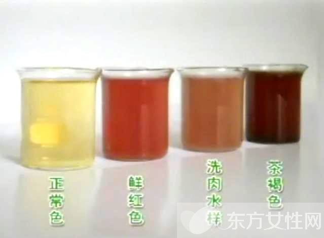 女人小便很黄怎么回事 怎么从尿的颜色看健康