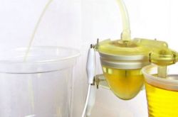 女人小便很黄怎么回事 小便后该用纸擦吗