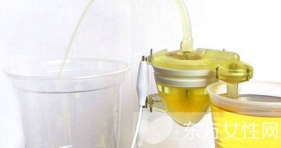 女人小便很黄怎么回事 小便后该用纸擦吗