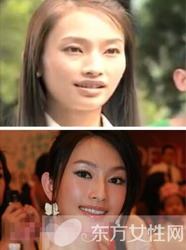 张俪王阳明分手真相 张丽个人资料整容照片遭扒