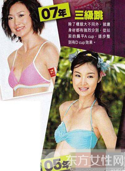 赵薇老公前女友叶翠翠图片 整容前后照遭吐槽变化惊人