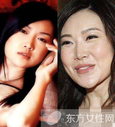 赵薇老公前女友叶翠翠图片 整容前后照遭吐槽变化惊人