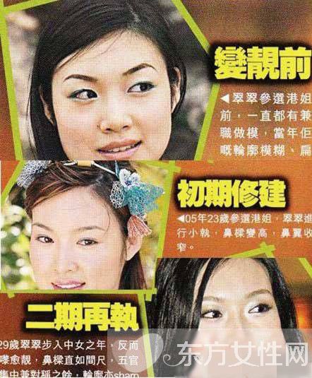 赵薇老公前女友叶翠翠图片 整容前后照遭吐槽变化惊人