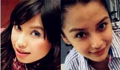 杨颖不雅睡样照片曝光 杨颖整容前后照流出大方承认整容