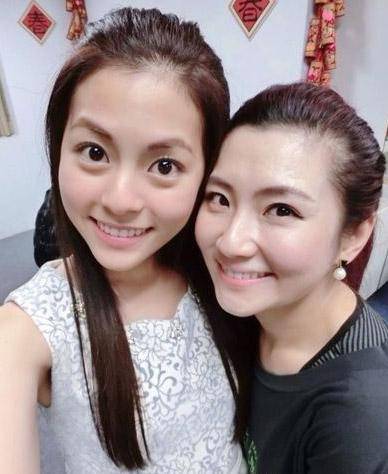 selina离婚真相大揭秘 selina烧伤前后照片对比