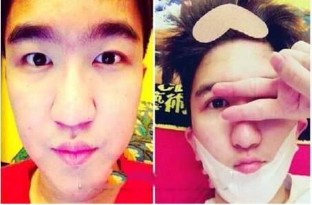 张大大身高是多少 张大大恶心炒作整容照遭扒