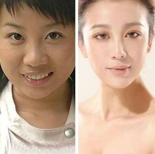 张冬玲和阿宝结婚照曝光 张冬玲的不良照片遭扒