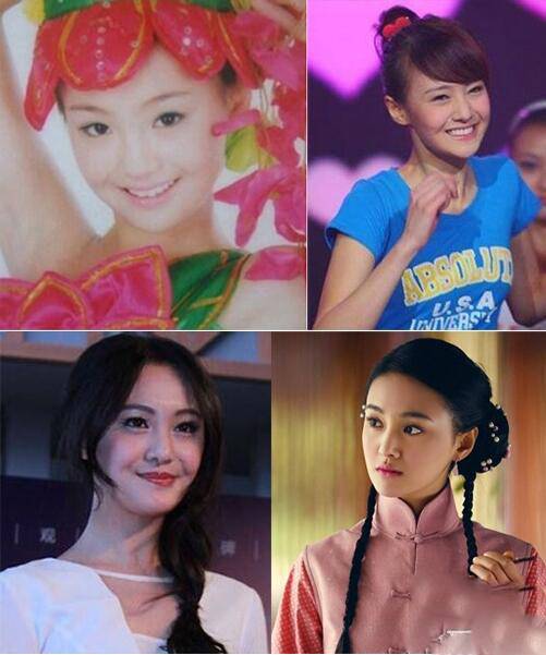 郑爽整容前后对比照片 揭与张翰分手的真正原因