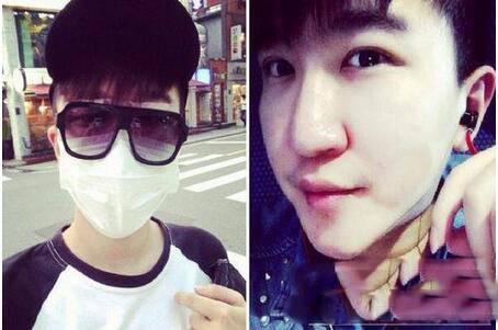 张大大身高是多少 张大大恶心炒作整容照遭扒