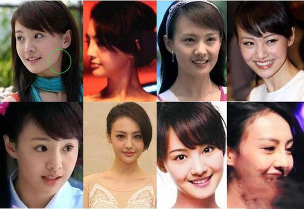 郑爽整容前后对比照片 揭与张翰分手的真正原因