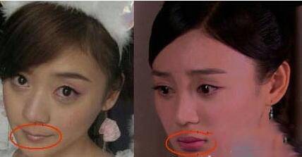 揭袁姗姗整容前后照片 与杨幂美貌事业大PK
