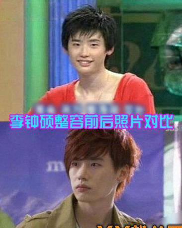 李钟硕个人资料外泄 李钟硕承认整容只瘦脸隆鼻