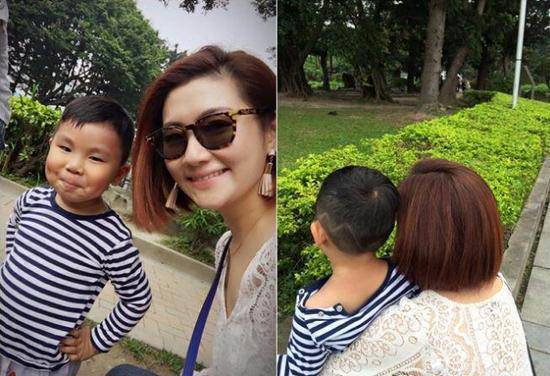 selina离婚真相大揭秘 selina烧伤前后照片对比