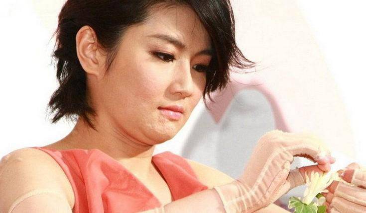 selina离婚真相大揭秘 selina烧伤前后照片对比