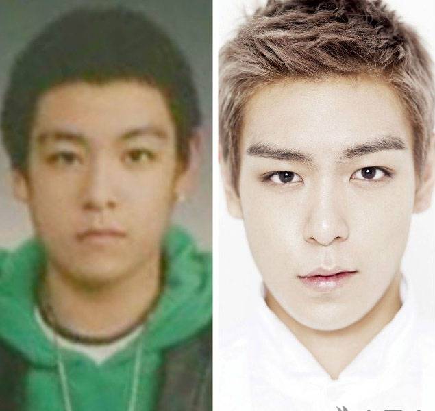 崔胜贤整容前后照片对比 Bigbang成员整容