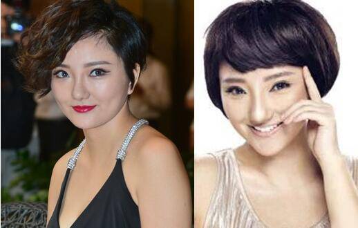 柳岩终于承认整容了 娱乐圈都有谁整了