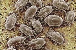 床上竟有200万只螨虫 5个实用除螨攻略