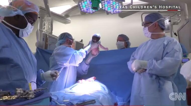 胎儿23周被取出子宫 手术后放回32周健康出生