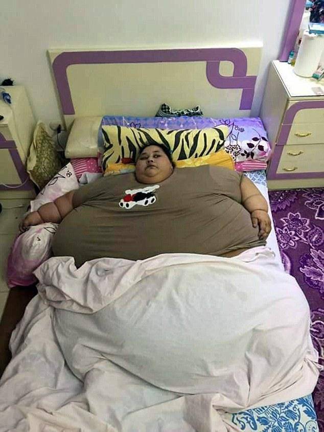 世界最胖女子25年未曾出门 体重已重达半吨