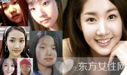 朴敏英整容前后照曝光 朴敏英三次大变身