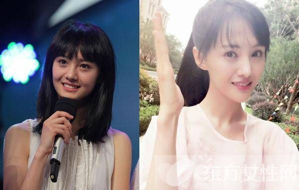 郑爽整容前后对比照 网友直呼郑爽太傻为张翰整容
