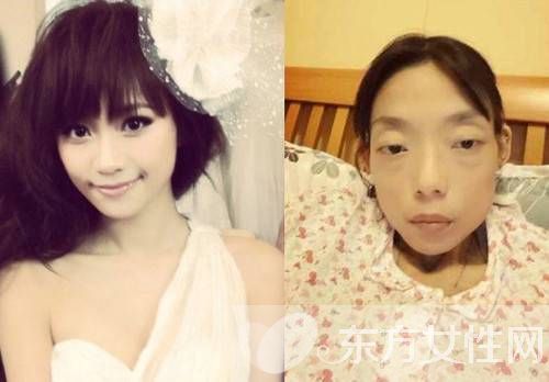 郭永淳迎娶杨爱瑾 前妻却重病暴瘦