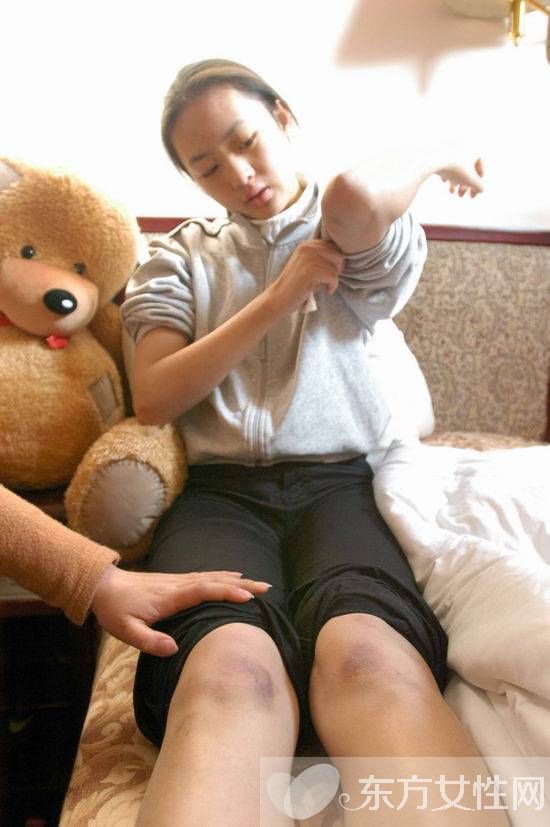 张默打伤女友童瑶事件始末 童谣个人资料