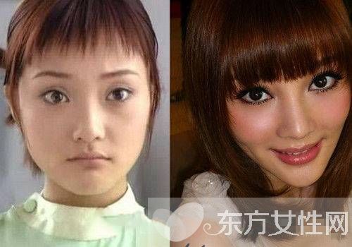 李小璐整容失败变脸瘫 老公贾乃亮力挺爱妻否认整容