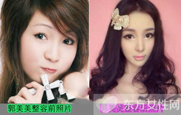 炫富女郭美美是谁 郭美美与干爹王军激战图遭曝光