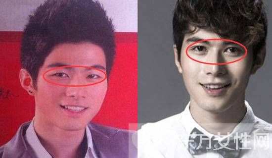 郭敬明撒娇陈学冬疑恋情坐实 陈学冬整容前后照差太多