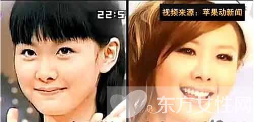  抢钱天后 安心亚整容前照片 安心亚否认李宗瑞淫照事件