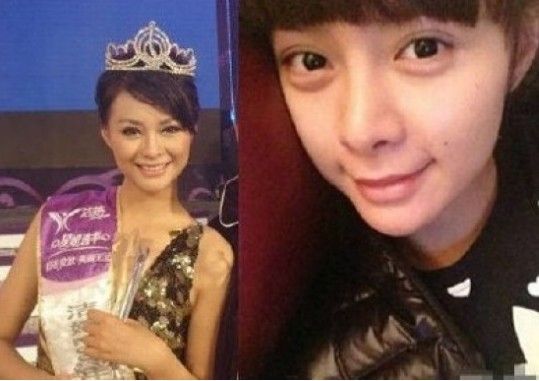 网曝杜海涛沈梦辰分手 揭秘沈梦辰整容过吗