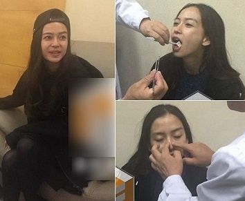 angelababy为何做整容鉴定 不想孩子看到报道蒙受委屈