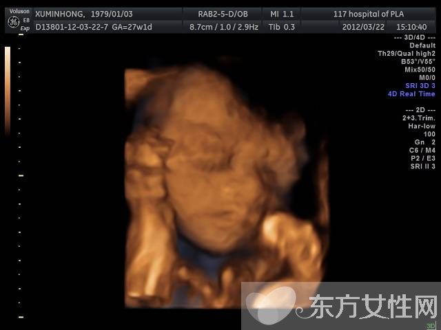 三维b超什么时候做 这些B超误区有多少妈妈知道