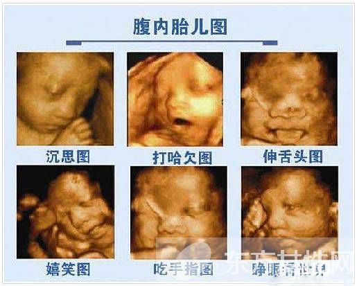 三维b超什么时候做 这些B超误区有多少妈妈知道