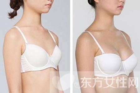 产后胸部下垂怎么办 只需六招便能重新力挺起来