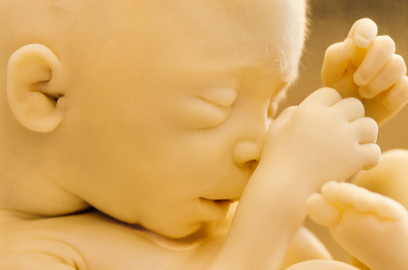 脐带绕颈一周怎么办 如何预防胎儿脐带绕颈